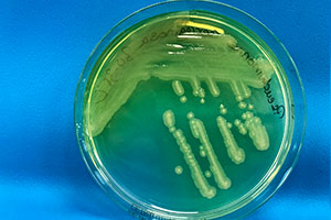 pictures: P.aeruginosa/B.cepacia/Shutterstock.com