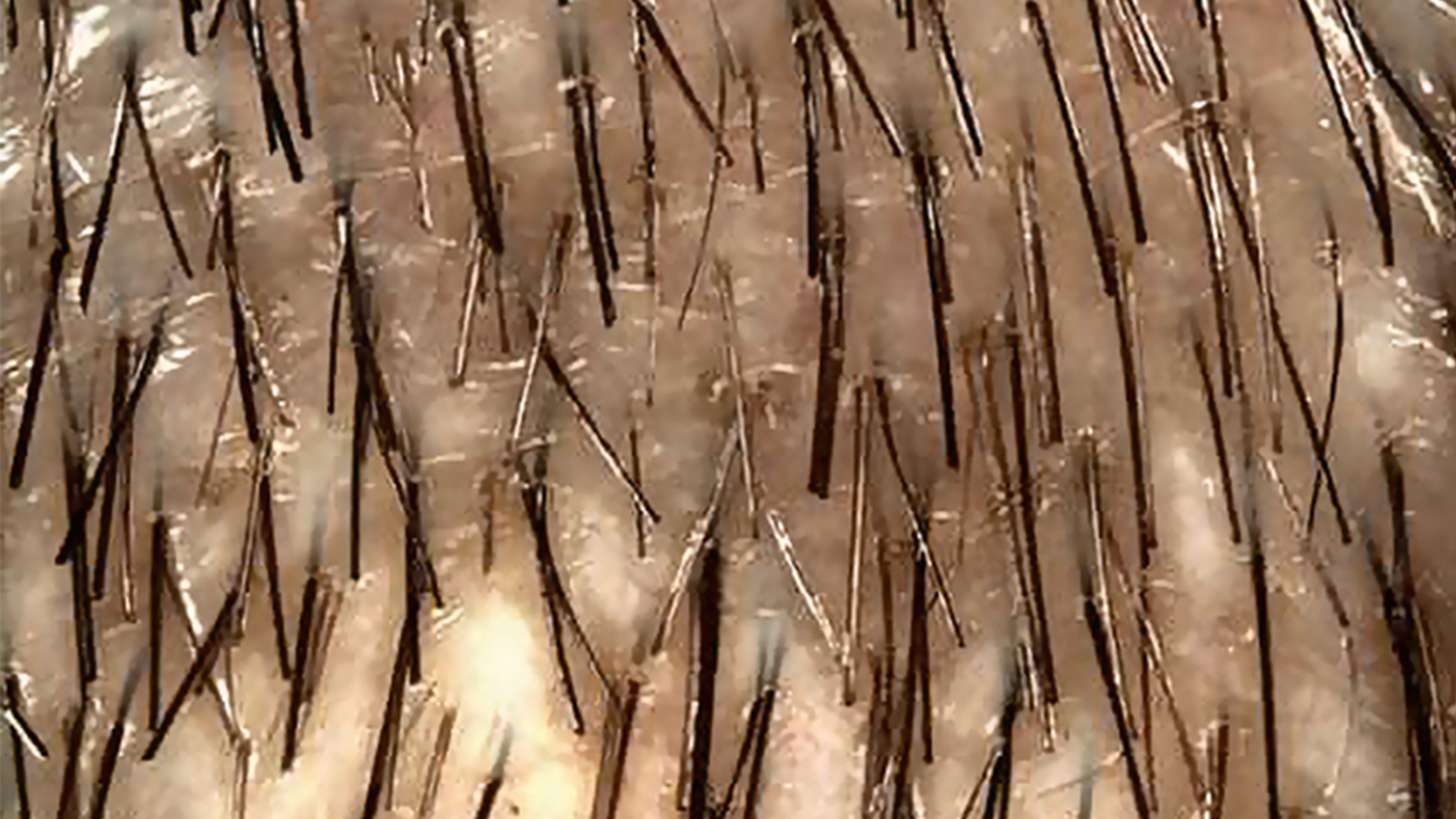 Figure 2: TrichoScan evolution images of application area. Photo: Provital Group