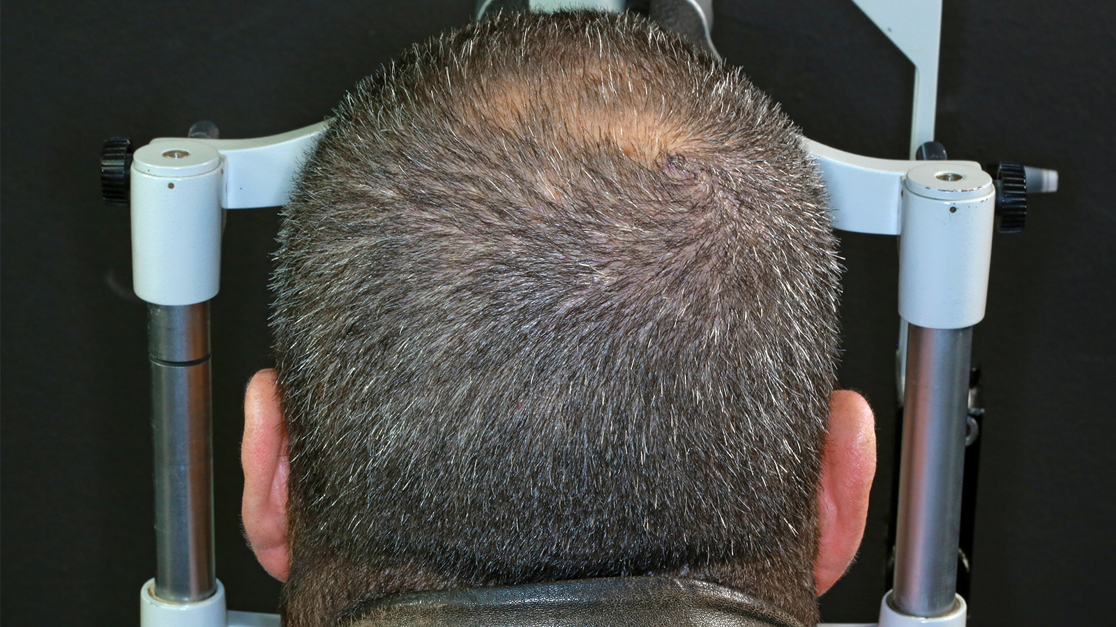 Figure 3: Standard images of application area. Photo: Provital Group