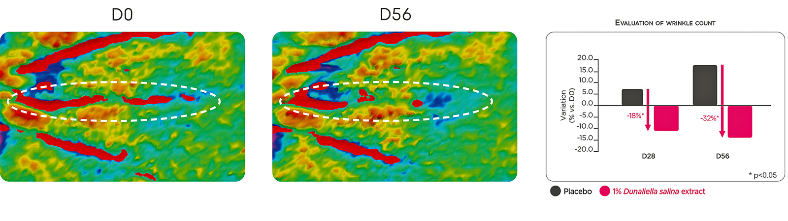 figure 2: Avea 3D evaluation of skin roughness. A. Illustrative images of the malar area. B. Quantification of skin roughness. figures: Lucas Meyer Cosmetics