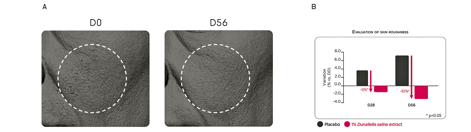 figure 3: Avea 3D evaluation of anti-wrinkle effect. A. Illustrative processed Avea 3D images of crow’s feet wrinkles (red represent wrinkle). B. Quantification of wrinkle count. figures: Lucas Meyer Cosmetics