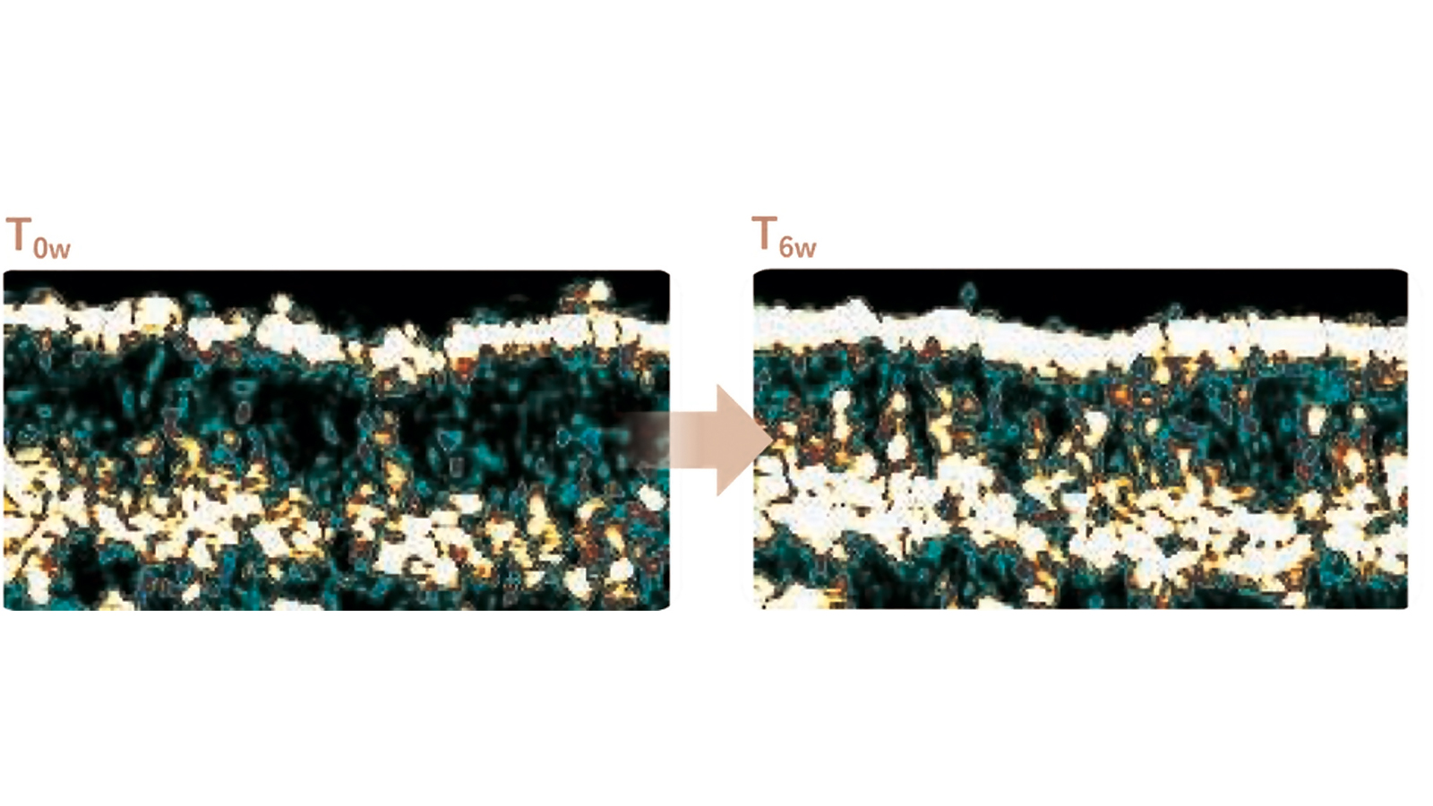 figure 2: Skin framework digital image treated with postbiotics (white bands are indicator of redensified areas). Photo: www.kalichem.it