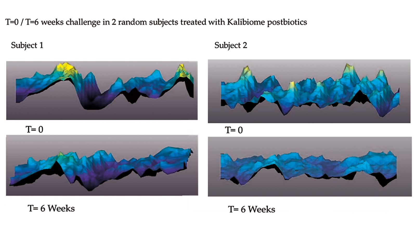 figure 3: Wrinkle depth reduction and surface regularization after 6 week treatment. Photo: www.kalichem.it