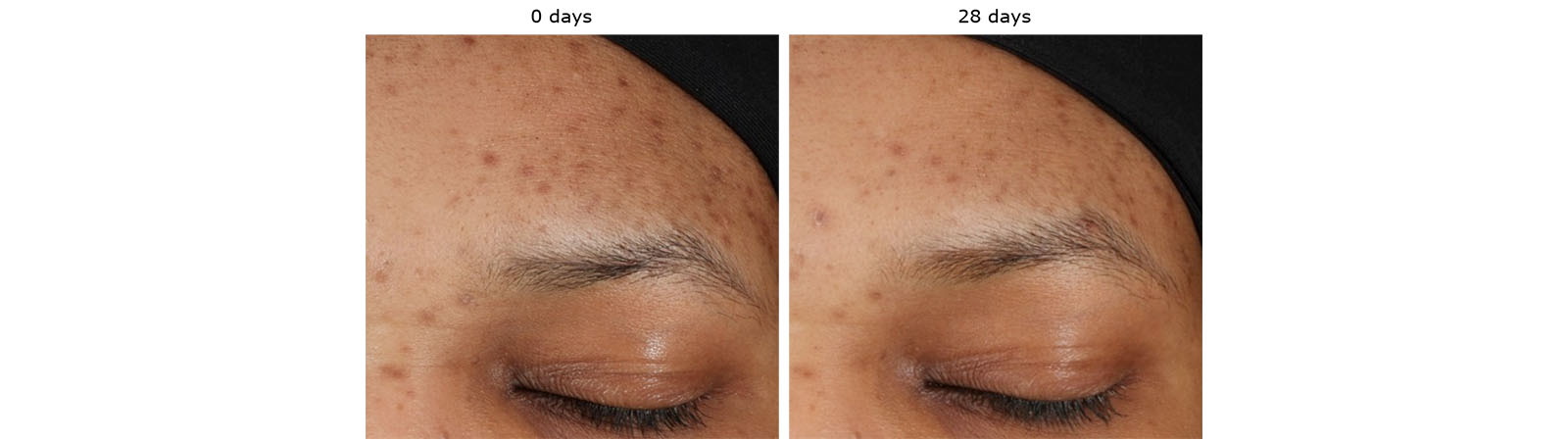figure 2: Image of a volunteer before and after the
