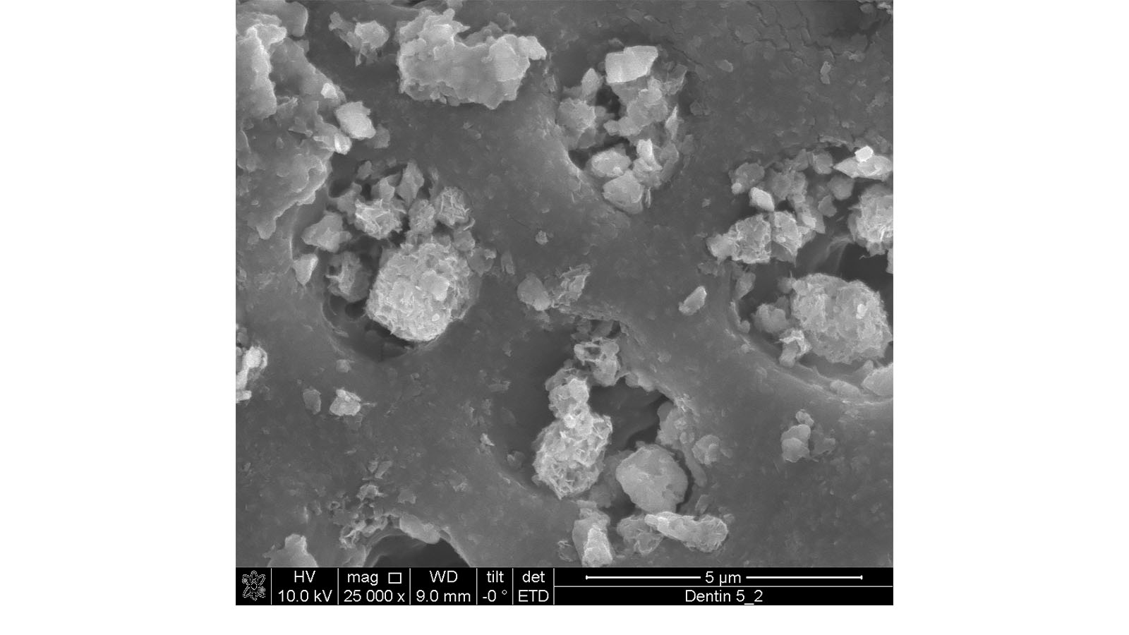 Figure 1. Scanning electron microscope image (SEM) of 5% Omyadent 220-OG particles. Photo: Omya