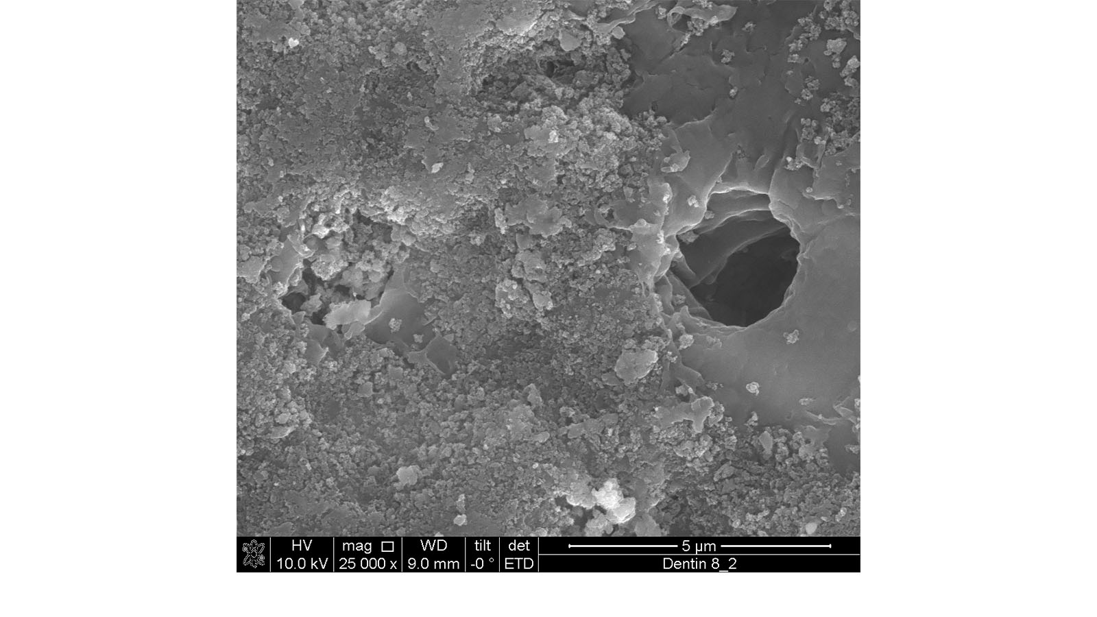 Figure 2. SEM image of Toothpaste with 5% Omyadent 220-OG particles. Photo: Omya