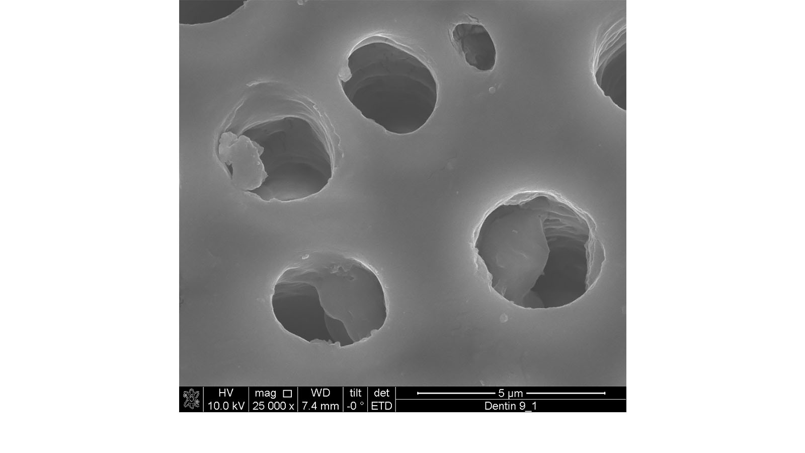 Figure 4. SEM image of a negative control with hydroxyethyl-cellulose. Photo: Omya