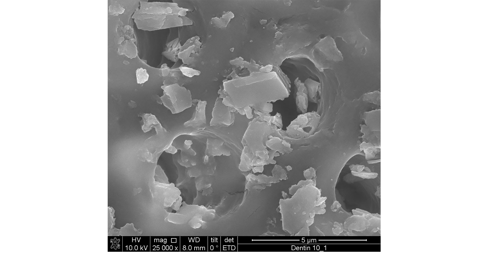 Figure 3. SEM image of a positive control with a market tooth-paste. Photo: Omya