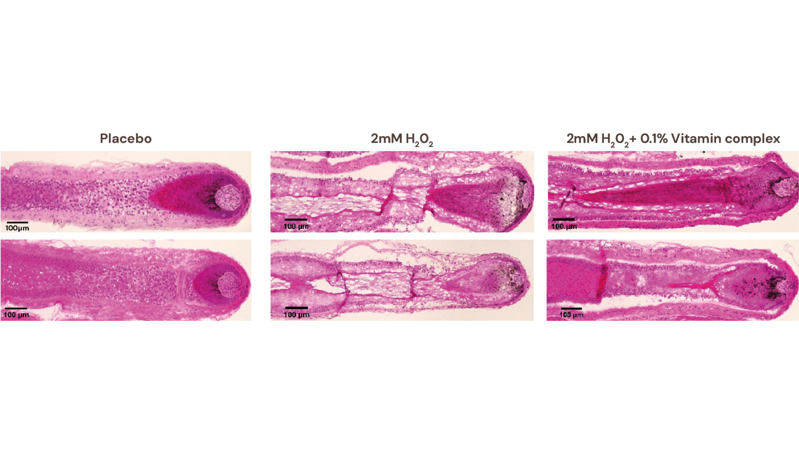 figure 3: In situ analysis of follicle morphology (light microscopy of hematoxylin/eosin-stained follicle cryosections) shows that the vitamin complex has a protective effect against dystrophy and tissue damage induced by hydrogen peroxide (H₂O₂).