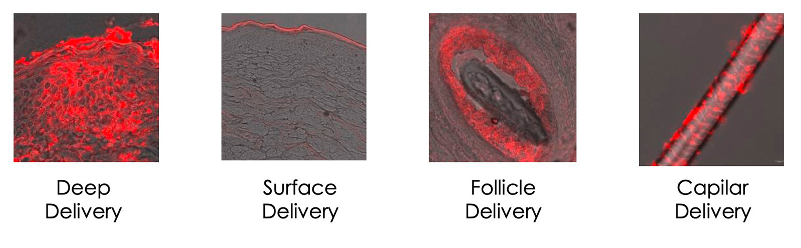 figure 3: Deliveries with specific cosmetic targets. figures: Indermal/nanovex Biotechnologies