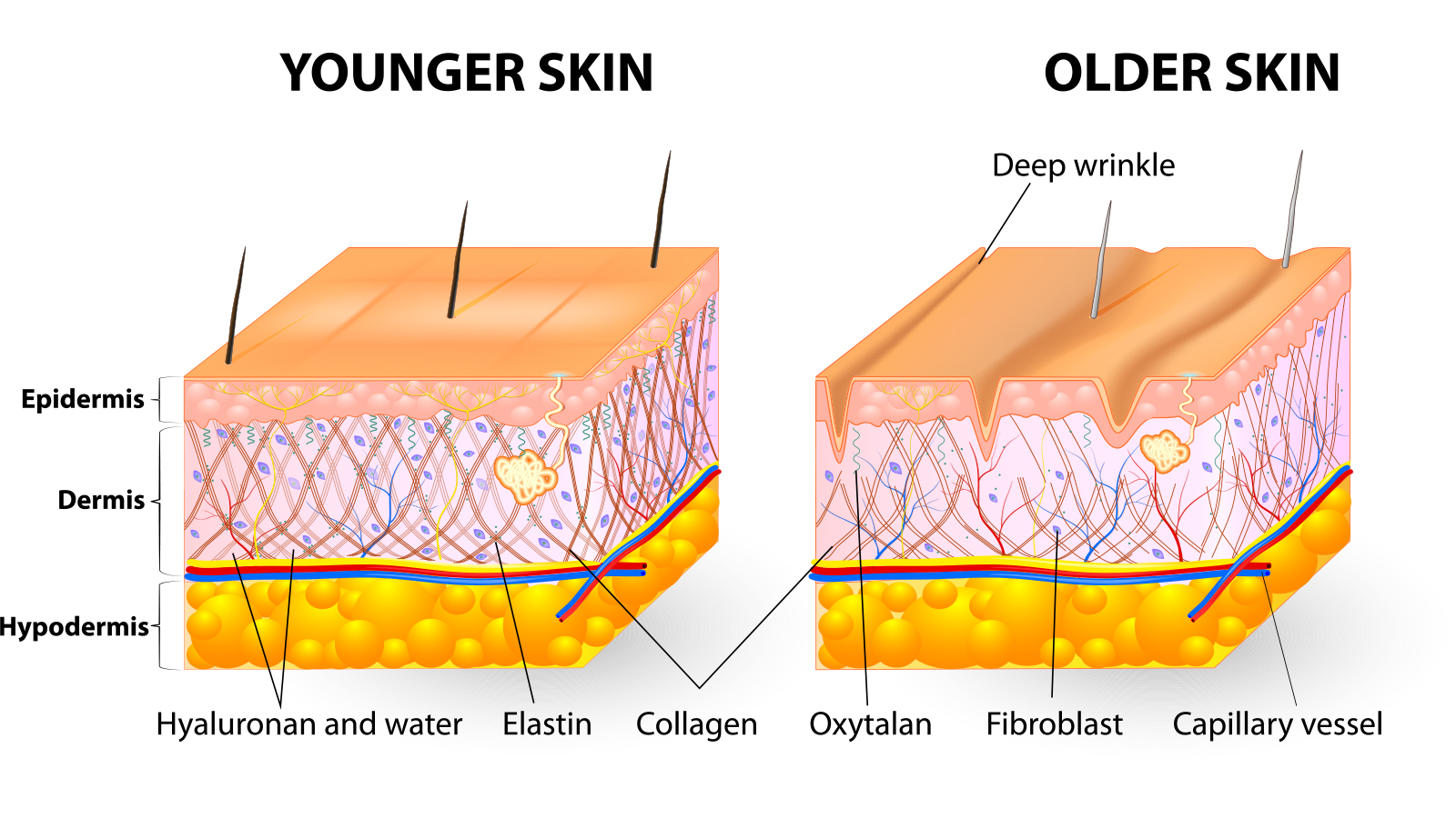 Excess of free radicals in skin contributes to premature skin ageing and wrinkling. Photo: Designua/Shutterstock.com